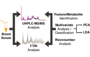 The Impact of the Serum Extraction Protocol on Metabolomic Profiling Using UPLC-MS/MS and FTIR Spectroscopy