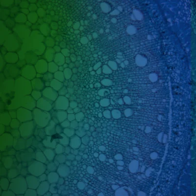 Applications of Free-Energy Calculations to Biomolecular Processes