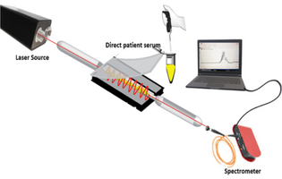 Plasmonic-Based Biosensor for the Early Diagnosis of Prostate Cancer